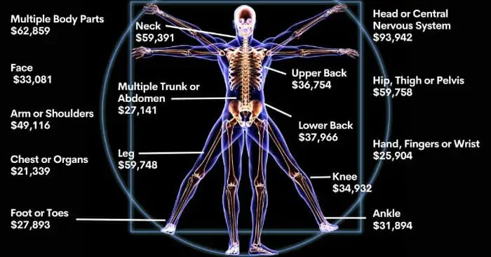 Workers' Comp Settlement